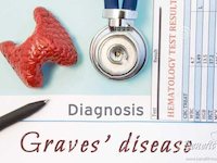 Grave's disease treatment in Korea